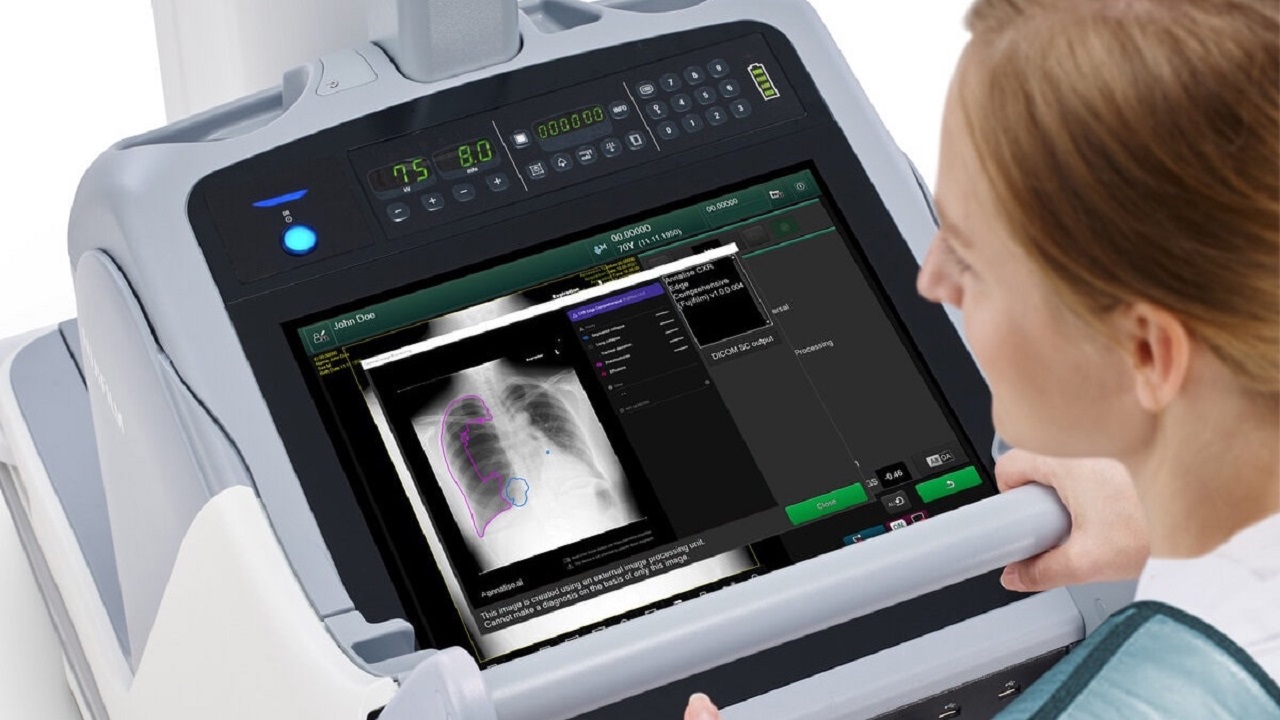 How Does a Flat-Panel Detector Enhance Digital X-ray Imaging Technology?